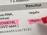 Коронавирус - PCR тест